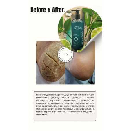 Podo Lime кератолитик UREA 25%